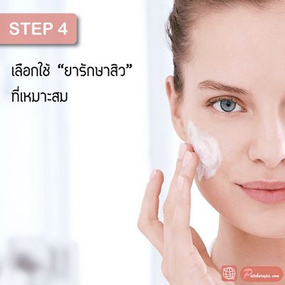 คุณจะรู้ได้อย่างไรว่าตัวเลือกการรักษาสิวใดที่เหมาะกับคุณ? Erythromycin และ